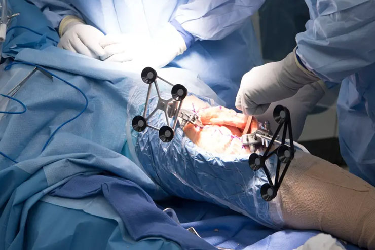 Orthopaedic Surgery
